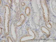 NDUFS3 Antibody - Immunoperoxidase of monoclonal antibody to NDUFS3 on formalin-fixed paraffin-embedded human kidney. [antibody concentration 3 ug/ml]
