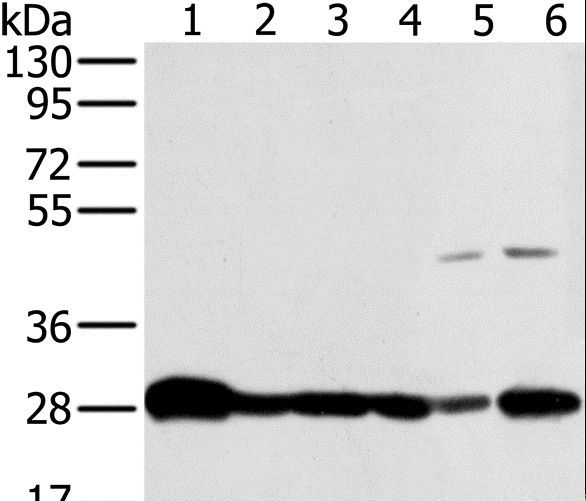 NDUFS3 Antibody - Western blot analysis of Mouse brain and human fetal brain tissue, HeLa, Raw264.7, NIH/3T3 and 293T cell, using NDUFS3 Polyclonal Antibody at dilution of 1:300.