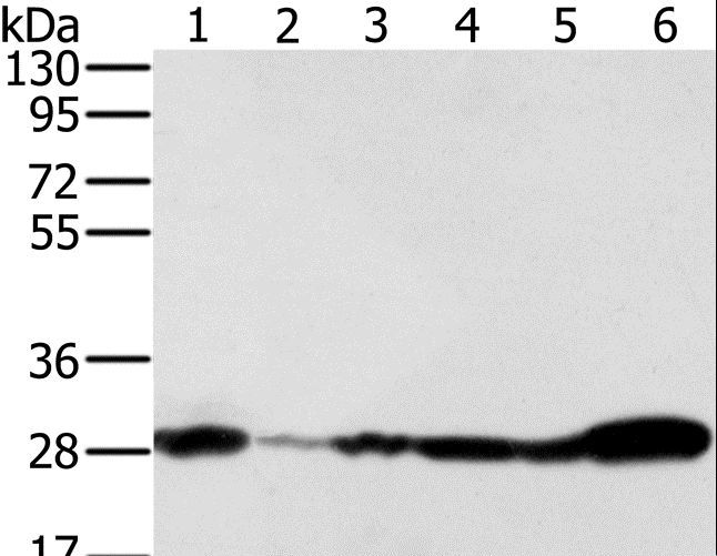 NDUFS3 Antibody - Western blot analysis of 293T, NIH/3T3, Raw264.7 and HeLa cell, human fetal brain and mouse brain tissue, using NDUFS3 Polyclonal Antibody at dilution of 1:350.