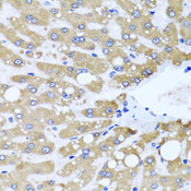 NDUFS3 Antibody - Immunohistochemistry of paraffin-embedded human liver injury tissue.
