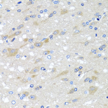 NDUFS3 Antibody - Immunohistochemistry of paraffin-embedded rat brain tissue.