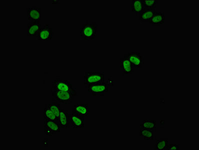 NDUFS3 Antibody - Immunofluorescent analysis of HepG2 cells diluted at 1:100 and Alexa Fluor 488-congugated AffiniPure Goat Anti-Rabbit IgG(H+L)