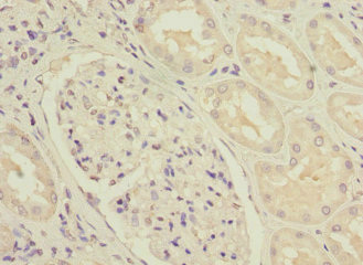 NDUFS3 Antibody - Immunohistochemistry of paraffin-embedded human kidney tissue at dilution 1:100