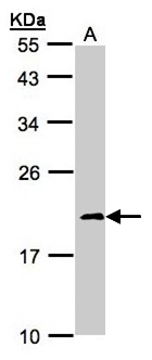 NDUFS4 Antibody - Sample (30g whole cell lysate). A:293T. 12% SDS PAGE. NDUFS4 antibody diluted at 1:1000