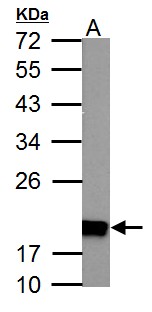 NDUFS4 Antibody - NDUFS4 antibody detects NDUFS4 protein by Western blot analysis. A. 50 ug Rat heart lysate/extract. 12% SDS-PAGE. NDUFS4 antibody dilution:1:1000.