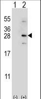 NDUFS4 Antibody - Western blot of NDUFS4 (arrow) using rabbit polyclonal NDUFS4 Antibody. 293 cell lysates (2 ug/lane) either nontransfected (Lane 1) or transiently transfected (Lane 2) with the NDUFS4 gene.