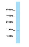 NDUFS4 Antibody - NDUFS4 antibody Western Blot of Fetal Lung.  This image was taken for the unconjugated form of this product. Other forms have not been tested.