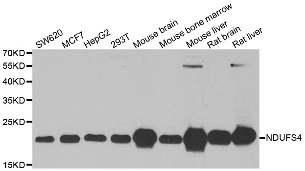 NDUFS4 Antibody - Western blot analysis of extracts of various cell lines.