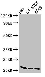 NDUFS4 Antibody - Positive Western Blot detected in U87 whole cell lysate, SH-SY5Y whole cell lysate, A549 whole cell lysate. All lanes: NDUFS4 antibody at 2.5 µg/ml Secondary Goat polyclonal to rabbit IgG at 1/50000 dilution. Predicted band size: 21 KDa. Observed band size: 21 KDa