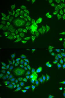 NDUFS4 Antibody - Immunofluorescence analysis of U2OS cells using NDUFS4 antibody. Blue: DAPI for nuclear staining.
