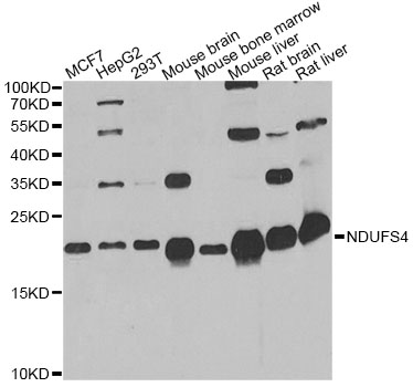 NDUFS4 Antibody - Western blot analysis of extracts of various cell lines, using NDUFS4 antibody at 1:1000 dilution. The secondary antibody used was an HRP Goat Anti-Rabbit IgG (H+L) at 1:10000 dilution. Lysates were loaded 25ug per lane and 3% nonfat dry milk in TBST was used for blocking. An ECL Kit was used for detection and the exposure time was 60s.