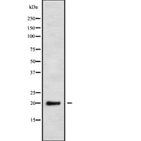 NDUFS4 Antibody - Western blot analysis NDUFS4 using K562 whole cells lysates