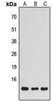 NDUFS5 Antibody - Western blot analysis of NDUFS5 expression in HUVEC (A); K562 (B); HepG2 (C) whole cell lysates.