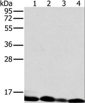 NDUFS5 Antibody - Western blot analysis of Human liver tissue and K562 cell, human fetal brain tissue and Raji cell, using NDUFS5 Polyclonal Antibody at dilution of 1:400.