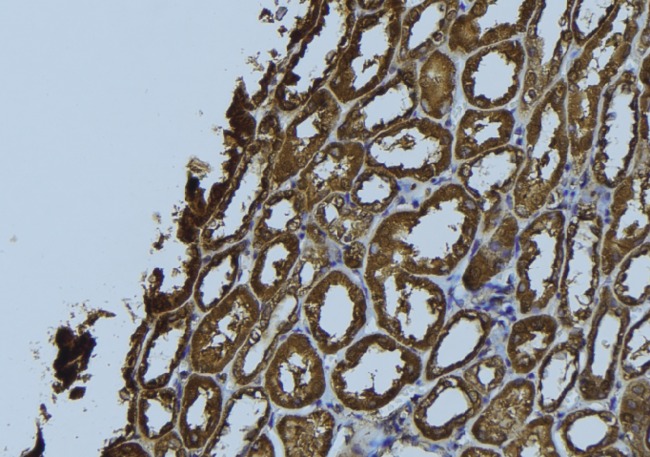 NDUFS5 Antibody - 1:100 staining rat kidney tissue by IHC-P. The sample was formaldehyde fixed and a heat mediated antigen retrieval step in citrate buffer was performed. The sample was then blocked and incubated with the antibody for 1.5 hours at 22°C. An HRP conjugated goat anti-rabbit antibody was used as the secondary.