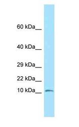 NDUFS6 Antibody - NDUFS6 antibody Western Blot of Mouse Small Intestine.  This image was taken for the unconjugated form of this product. Other forms have not been tested.