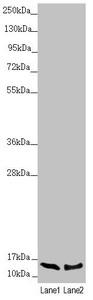 NDUFS6 Antibody - Western blot All Lanes:NDUFS6 antibody at 1.67 ug/ml Lane 1: Mouse brain tissue Lane 2: HepG-2 whole cell lysate Secondary Goat polyclonal to rabbit IgG at 1/10000 dilution Predicted band size: 14 kDa Observed band size: 14 kDa