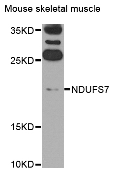NDUFS7 Antibody - Western blot analysis of extracts of Mouse skeletal muscle cells.