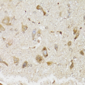 NDUFS7 Antibody - Immunohistochemistry of paraffin-embedded mouse brain tissue.