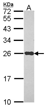NDUFS8 Antibody - Sample (30 ug of whole cell lysate). A: Hep G2 . 12% SDS PAGE. NDUFS8 antibody. NDUFS8 antibody diluted at 1:1000.