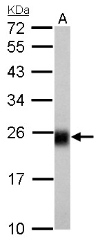NDUFS8 Antibody - NDUFS8 antibody detects NDUFS8 protein by Western blot analysis. A. 50 ug rat brain lysate/extract. 12 % SDS-PAGE. NDUFS8 antibody dilution:1:1000