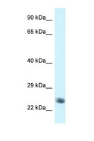 NDUFS8 Antibody - NDUFS8 antibody Western blot of Jurkat Cell lysate. Antibody concentration 1 ug/ml.  This image was taken for the unconjugated form of this product. Other forms have not been tested.