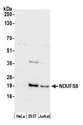 NDUFS8 Antibody - Detection of human NDUFS8 by western blot. Samples: Whole cell lysate (50 µg) from HeLa, HEK293T, and Jurkat cells prepared using NETN lysis buffer. Antibody: Affinity purified rabbit anti-NDUFS8 antibody used for WB at 0.1 µg/ml. Detection: Chemiluminescence with an exposure time of 30 seconds.