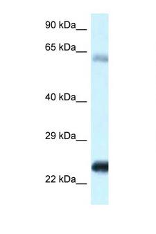 NDUFS8 Antibody - NDUFS8 antibody Western blot of Fetal Heart lysate. Antibody concentration 1 ug/ml. This image was taken for the unconjugated form of this product. Other forms have not been tested.