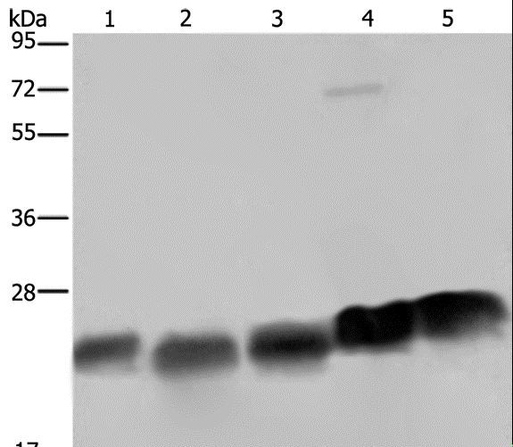 NDUFS8 Antibody - Western blot analysis of K562, HeLa and Jurkat cell, mouse heart and spleen tissue, using NDUFS8 Polyclonal Antibody at dilution of 1:250.