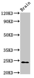 NDUFS8 Antibody - Positive Western Blot detected in Rat brain tissue. All lanes: NDUFS8 antibody at 2.7 µg/ml Secondary Goat polyclonal to rabbit IgG at 1/50000 dilution. Predicted band size: 24 KDa. Observed band size: 24 KDa