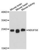 NDUFS8 Antibody - Western blot analysis of extracts of various cell lines, using NDUFS8 antibody at 1:3000 dilution. The secondary antibody used was an HRP Goat Anti-Rabbit IgG (H+L) at 1:10000 dilution. Lysates were loaded 25ug per lane and 3% nonfat dry milk in TBST was used for blocking. An ECL Kit was used for detection and the exposure time was 90s.