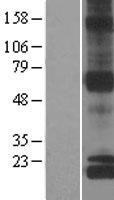 NDUFS8 Protein - Western validation with an anti-DDK antibody * L: Control HEK293 lysate R: Over-expression lysate