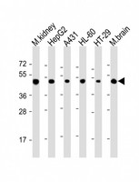 NDUFV1 Antibody - All lanes: Anti-NDUFV1 Antibody (Center) at 1:2000 dilution. Lane 1: mouse kidney lysate. Lane 2: HepG2 whole cell lysate. Lane 3: A431 whole cell lysate. Lane 4: HL-60 whole cell lysate. Lane 5: HT-29 whole cell lysate. Lane 6: mouse brain lysate Lysates/proteins at 20 ug per lane. Secondary Goat Anti-Rabbit IgG, (H+L), Peroxidase conjugated at 1:10000 dilution. Predicted band size: 51 kDa. Blocking/Dilution buffer: 5% NFDM/TBST.