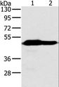 NDUFV1 Antibody - Western blot analysis of Mouse heart and brain tissue, using NDUFV1 Polyclonal Antibody at dilution of 1:500.
