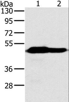 NDUFV1 Antibody - Western blot analysis of Mouse heart and brain tissue, using NDUFV1 Polyclonal Antibody at dilution of 1:500.