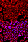 NDUFV1 Antibody - Immunofluorescence analysis of A549 cells.