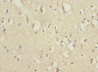 NDUFV1 Antibody - Immunohistochemistry of paraffin-embedded human brain tissue at dilution 1:100