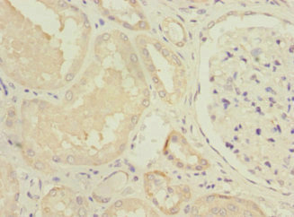 NDUFV1 Antibody - Immunohistochemistry of paraffin-embedded human kidney tissue at dilution 1:100