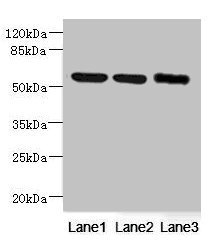 NDUFV1 Antibody - Western blot All Lanes: NDUFV1 antibody at 3.46ug/ml Lane 1: Mouse kidney tissue Lane 2: HT29 whole cell lysate Lane 3: HepG-2 whole cell lysate Goat polyclonal to Rabbit IgG at 1/10000 dilution Predicted band size: 51,50 kDa Observed band size: 51 kDa