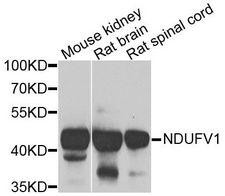 NDUFV1 Antibody - Western blot analysis of extracts of various cell lines, using NDUFV1 antibody at 1:1000 dilution. The secondary antibody used was an HRP Goat Anti-Rabbit IgG (H+L) at 1:10000 dilution. Lysates were loaded 25ug per lane and 3% nonfat dry milk in TBST was used for blocking. An ECL Kit was used for detection and the exposure time was 90s.