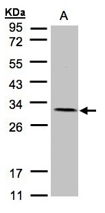 NDUFV2 Antibody - Sample (30 ug of whole cell lysate). A: A431. 12% SDS PAGE. NDUFV2 antibody diluted at 1:1500.