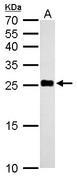 NDUFV2 Antibody - NDUFV2 antibody detects NDUFV2 protein by Western blot analysis. A. 50 ug mouse liver lysate/extract. 12 % SDS-PAGE. NDUFV2 antibody dilution:1:500