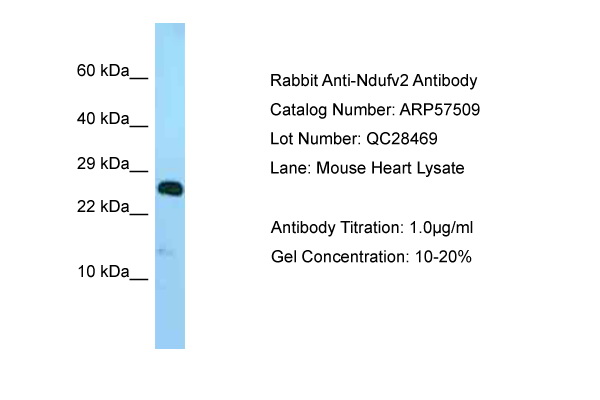 NDUFV2 Antibody -  This image was taken for the unconjugated form of this product. Other forms have not been tested.