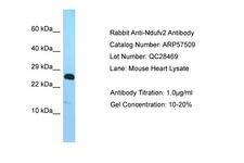 NDUFV2 Antibody -  This image was taken for the unconjugated form of this product. Other forms have not been tested.