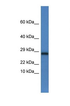 NDUFV2 Antibody - NDUFV2 antibody Western blot of Mouse Brain lysate. Antibody concentration 1 ug/ml. This image was taken for the unconjugated form of this product. Other forms have not been tested.