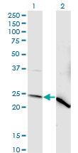 NDUFV2 Antibody - Western Blot analysis of NDUFV2 expression in transfected 293T cell line by NDUFV2 monoclonal antibody (M03), clone 1A10.Lane 1: NDUFV2 transfected lysate (Predicted MW: 27.4 KDa).Lane 2: Non-transfected lysate.