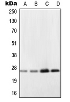 NDUFV2 Antibody - Western blot analysis of NDUFV2 expression in A431 (A); Ramos (B); HepG2 (C); NIH3T3 (D) whole cell lysates.
