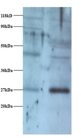 NDUFV2 Antibody - Western blot of NADH dehydrogenase flavoprotein 2, mitochondrial antibody at 2 ug/ml. Lane 1: EC109 whole cell lysate. Lane 2: 293T whole cell lysate. Secondary: Goat polyclonal to Rabbit IgG at 1:15000 dilution. Predicted band size: 27 kDa. Observed band size: 27 kDa Additional bands at: 40 kDa. We are unsure as to the identity of this extra band.  This image was taken for the unconjugated form of this product. Other forms have not been tested.