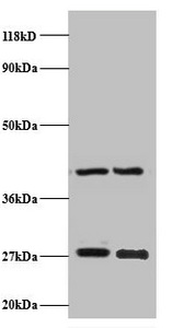 NDUFV2 Antibody - Western blot All lanes: NADH dehydrogenase flavoprotein 2, mitochondrial antibody at 2µg/ml Lane 1: EC109 whole cell lysate Lane 2: 293T whole cell lysate Secondary Goat polyclonal to rabbit IgG at 1/15000 dilution Predicted band size: 27 kDa Observed band size: 27 kDa