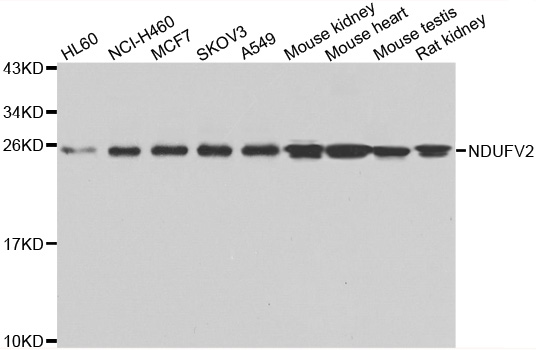NDUFV2 Antibody - Western blot analysis of extracts of various cell lines.